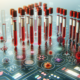 Allergy Blood Tests: Essential Tips and Insights You Need