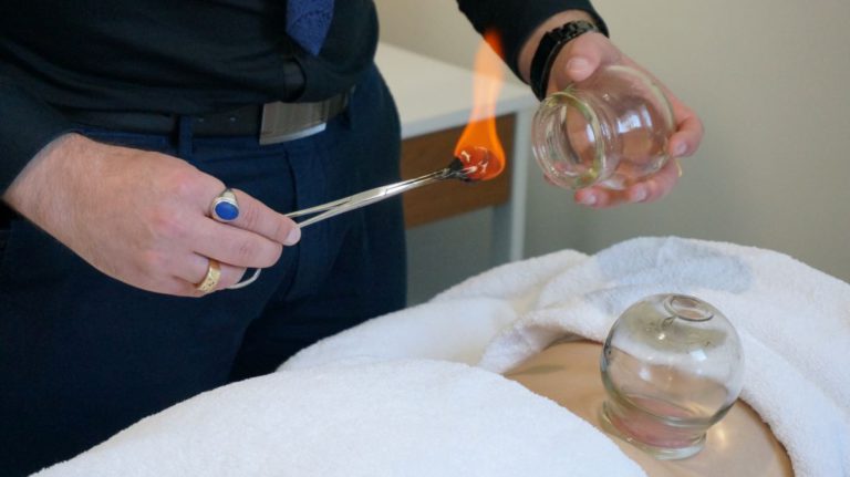 Cupping Therapy Benefits: Experience Healing in Melbourne