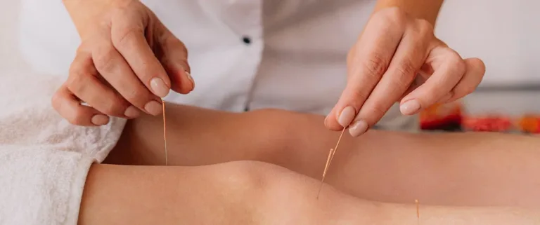 Acupuncture for Stress and Anxiety Relief: An Overview