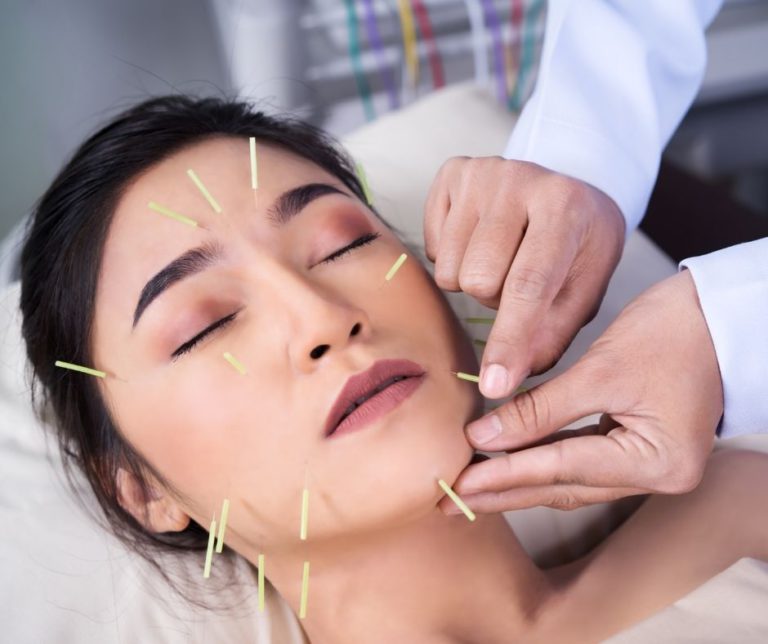 Cosmetic Acupuncture: Key Disadvantages to Consider